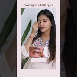 1771073385 hqdefault