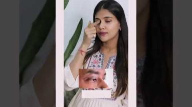 Signs of Skin Allergy? #skin #skinallergy #skinproblems #skincare #skinspecialist #shorts #ytshorts 18 1771073385 hqdefault