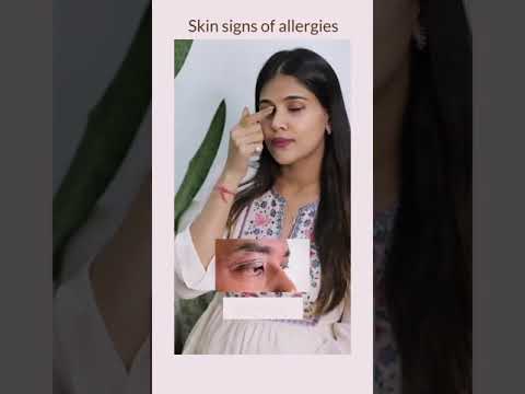 1771073385 hqdefault