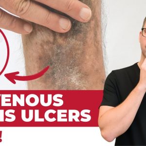 1771162548 maxresdefault