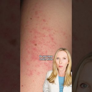 1771168660 maxresdefault