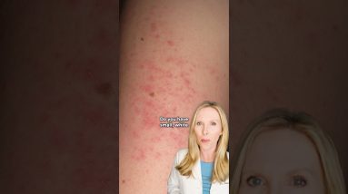 1771168660 maxresdefault