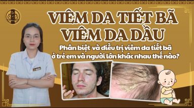 PHÂN BIỆT VÀ CÁCH ĐIỀU TRỊ VIÊM DA TIẾT BÃ Ở TRẺ SƠ SINH VÀ VIÊM DA TIẾT BÃ Ở NGƯỜI LỚN 18 1771172624 maxresdefault