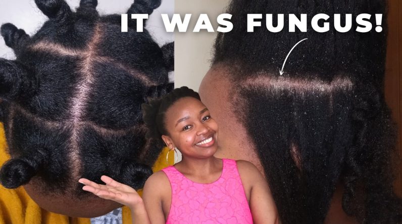 1771190925 maxresdefault