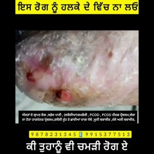 1771228915 maxresdefault