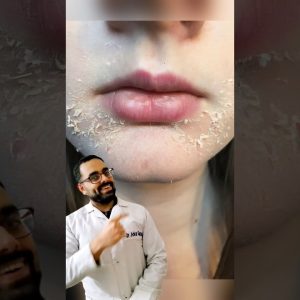 1771232208 maxresdefault