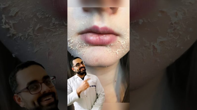 1771232208 maxresdefault