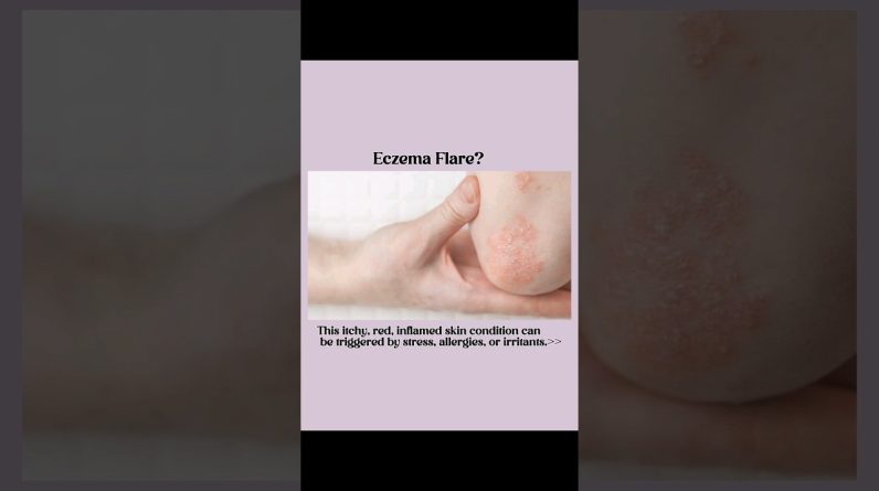 1771243187 maxresdefault