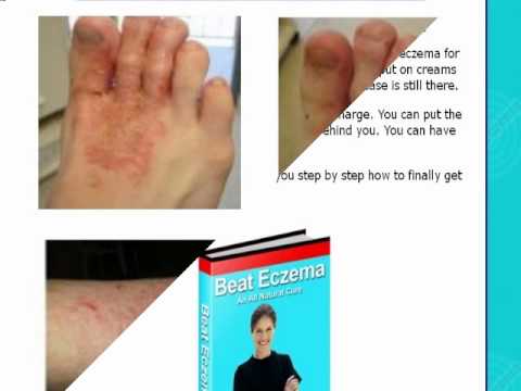 1771323643 hqdefault