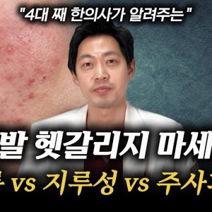 1771324185 maxresdefault