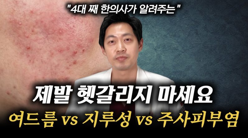 1771324185 maxresdefault