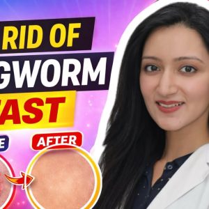 1771407104 maxresdefault