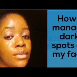 1771434045 hqdefault