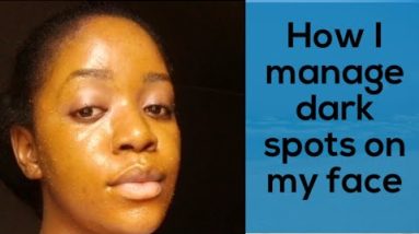 1771434045 hqdefault