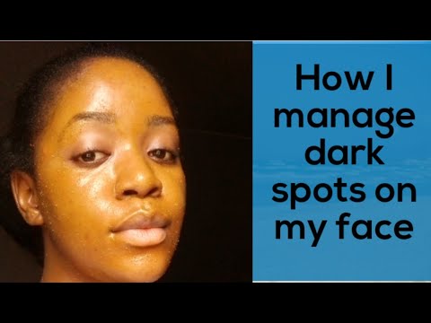 1771434045 hqdefault