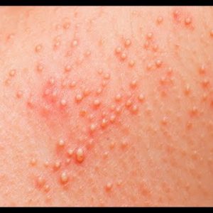 1771495722 hqdefault