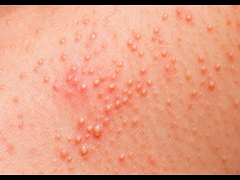 1771495722 hqdefault