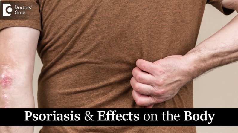 1771509163 maxresdefault