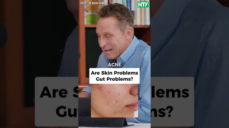 1771601297 maxresdefault