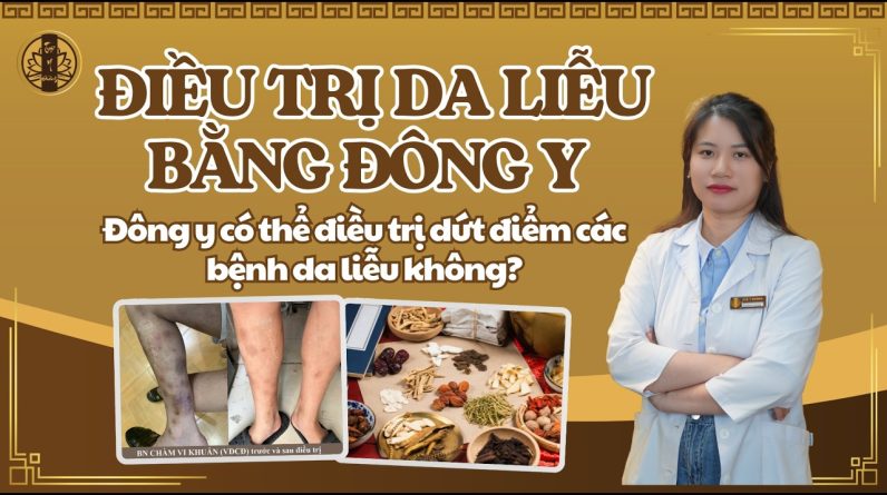 1771615914 maxresdefault