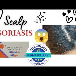 1771634180 hqdefault