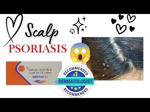 1771634180 hqdefault