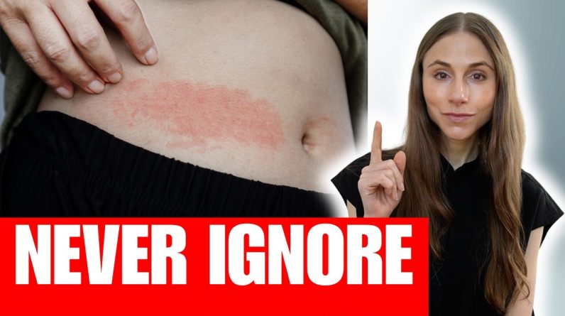 1771652503 maxresdefault