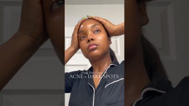 1771772988 maxresdefault