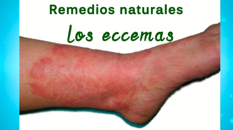 1771787631 maxresdefault