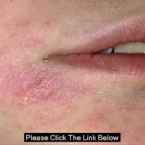 1771794954 hqdefault