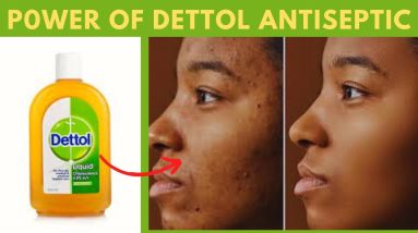 1771798611 maxresdefault