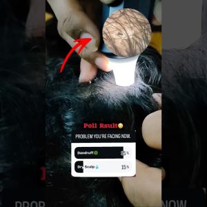 1771908883 maxresdefault