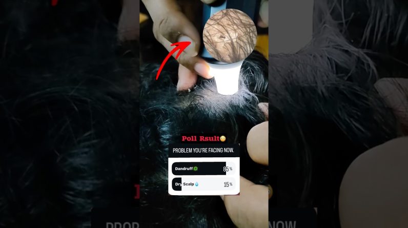 1771908883 maxresdefault