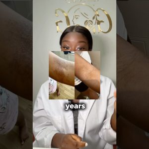 1771923654 maxresdefault