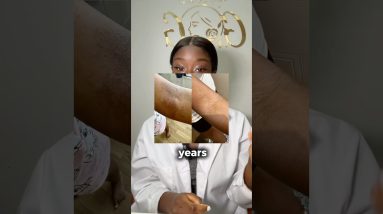 1771923654 maxresdefault