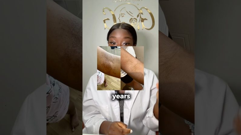 1771923654 maxresdefault