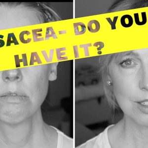 1771932465 maxresdefault