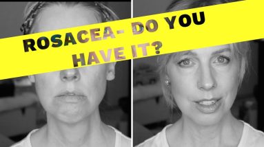 1771932465 maxresdefault