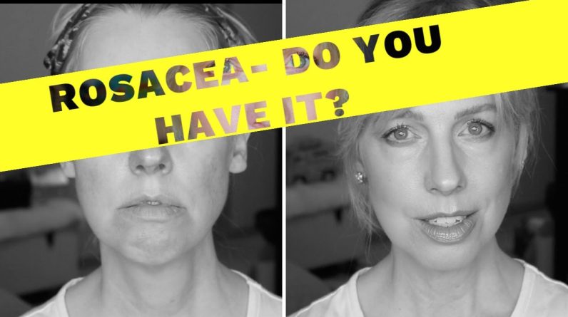 1771932465 maxresdefault