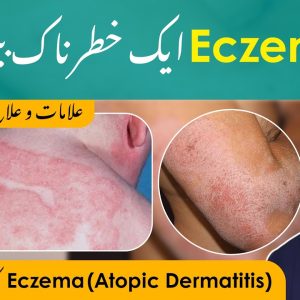 1771945611 maxresdefault