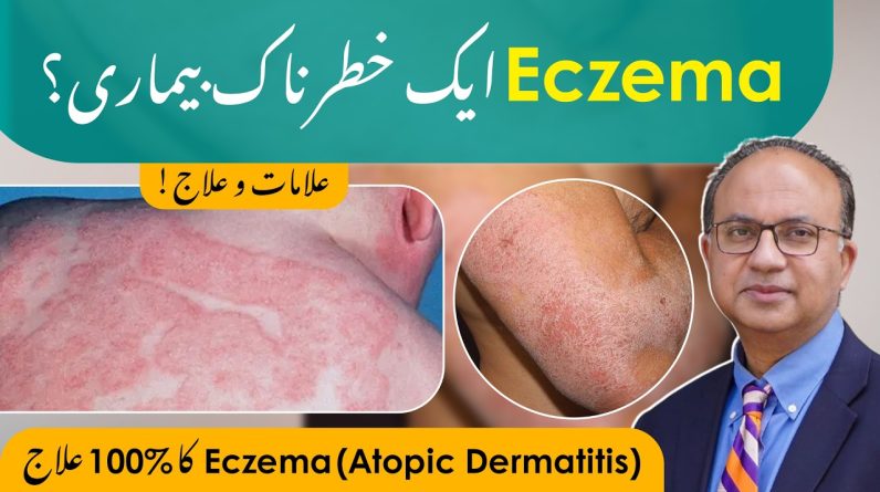 1771945611 maxresdefault