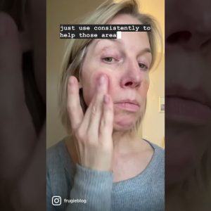 1771975005 maxresdefault