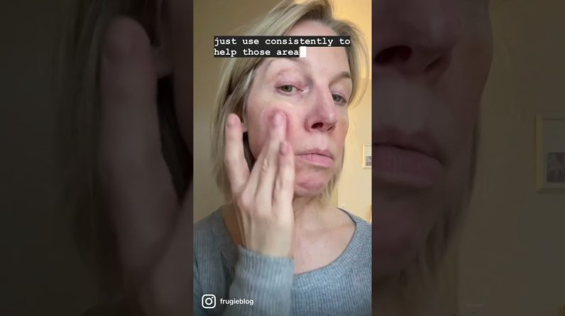 1771975005 maxresdefault