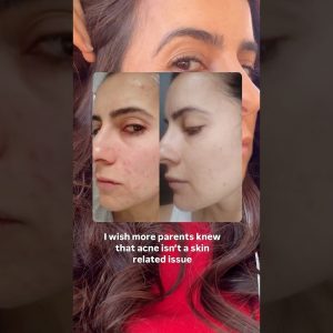 1772011607 maxresdefault