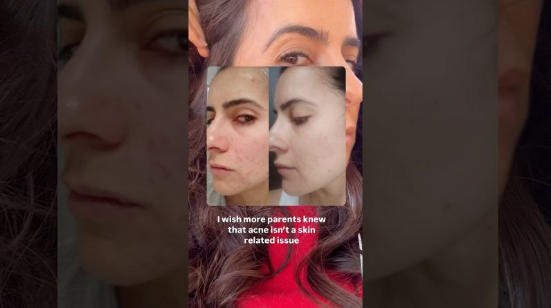 1772011607 maxresdefault