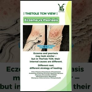 1772018961 maxresdefault