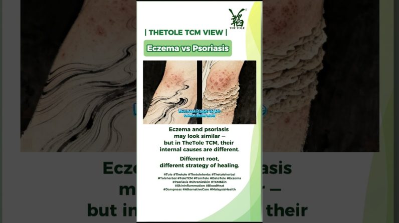 1772018961 maxresdefault