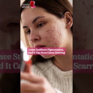 1772181473 maxresdefault