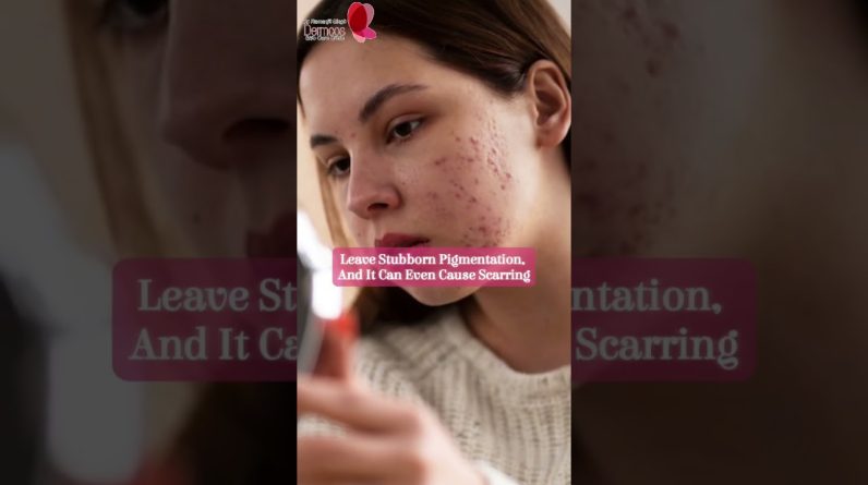 1772181473 maxresdefault