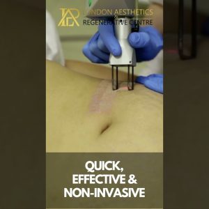 1772183623 maxresdefault